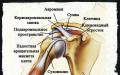 Skulderluxation - orsaker, symtom och behandling