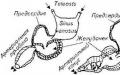 Valvulär sammandragning av conus arteriosus